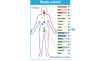 蛋白質組學分析揭示多組織中鱗狀細胞癌和腺癌的關鍵區別