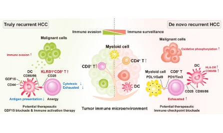 干濕結合分析不同復發肝癌之間不同的免疫生態系統