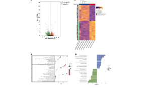 SXR2023030013C+聯合RNA-seq的免疫浸潤與單細胞數據分析免疫微環境，簡直絕配~