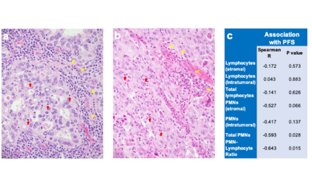使用小鼠模型探究阿來替尼的反應(yīng)機(jī)制