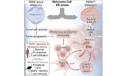 內質網應激的癌細胞如何調節抗腫瘤免疫？
