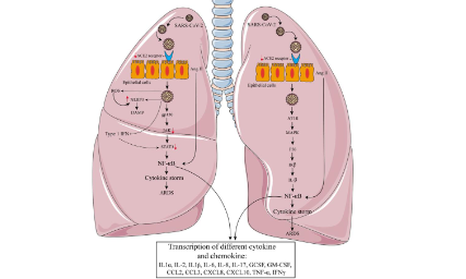 SXR2023030027C+COVID-19中的免疫衰老和炎癥衰老