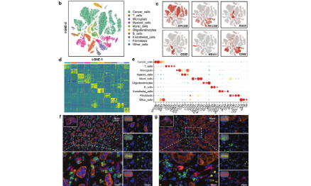 乳腺癌肝腦轉移瘤內異質性如何發17+純生信