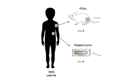 單細胞分析和功能表征揭示了橫紋肌肉瘤的干細胞譜系和發育起源