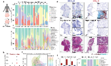 Nature重磅 | 腫瘤微生物促進腫瘤異質性