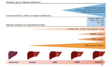 SXR202206006C “肝臟中的癌前病變”-不蹭熱點，關注臨床問題（萬字綜述解讀）