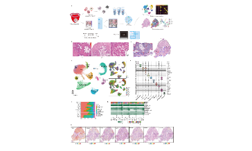 SXR2023030038C_jing_單細胞結合空間轉錄數據的38+癌前病變研究方案