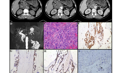 只有四個(gè)樣的單細(xì)胞分析怎么就沖到40+了呢？